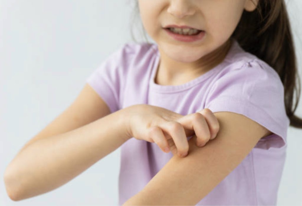  KIŞ ALERJİLERİ NEDİR ?