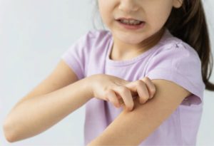  KIŞ ALERJİLERİ NEDİR ?