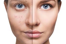 KIŞA GİRMEDEN CİLDİNİZİ YENİLEYİN